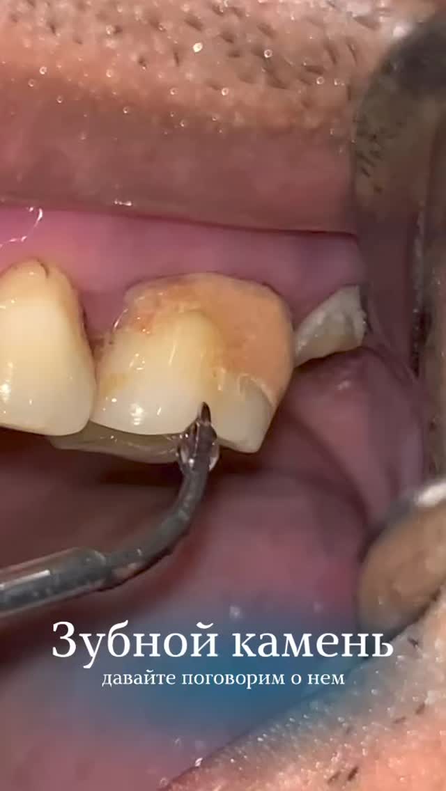 Профессиональная гигиена