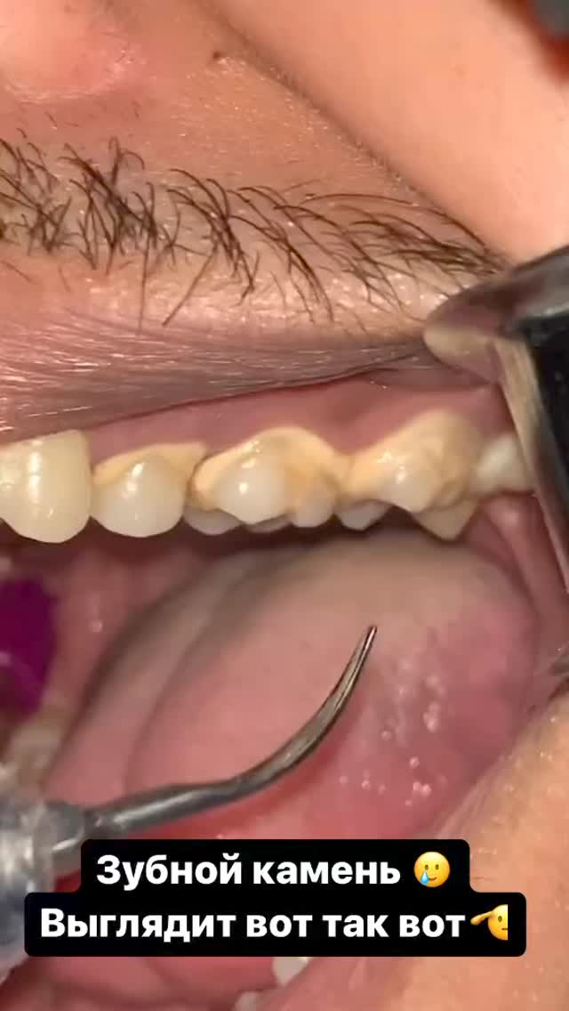 Лечение под микроскопом