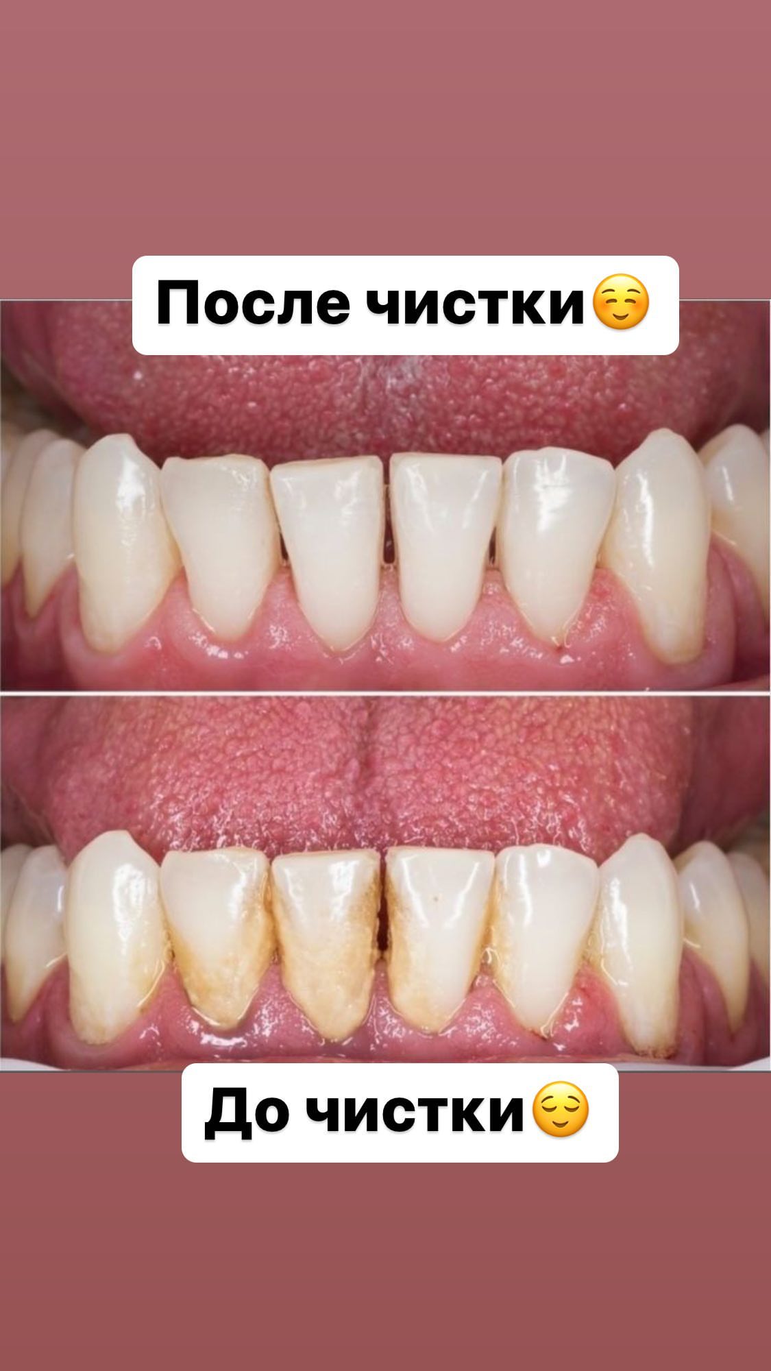 Профессиональная чистка