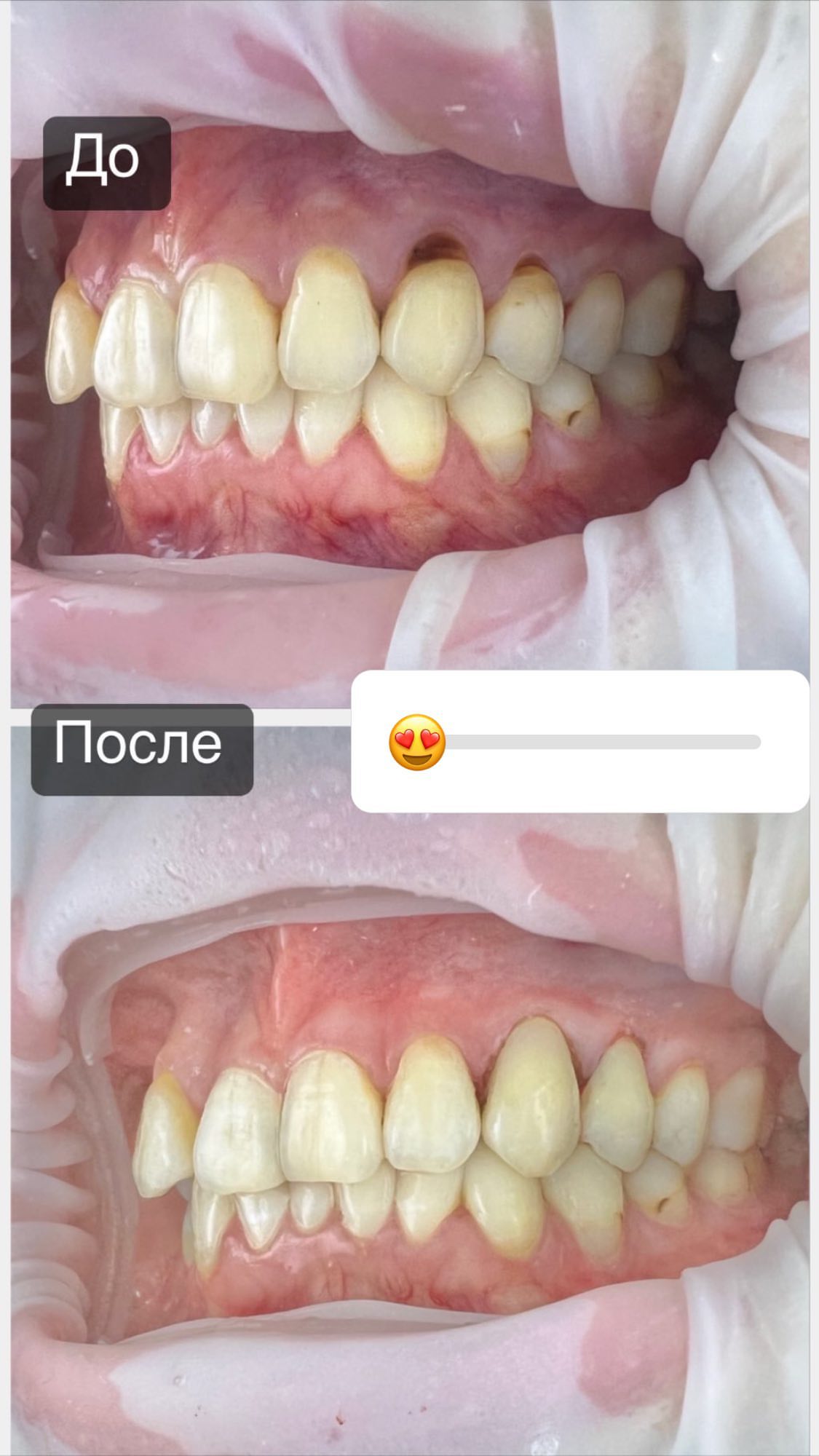 После лечения