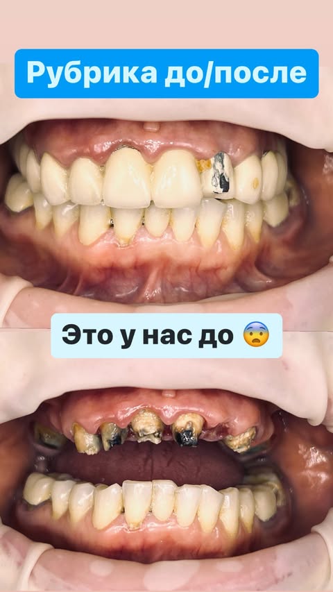 После лечения