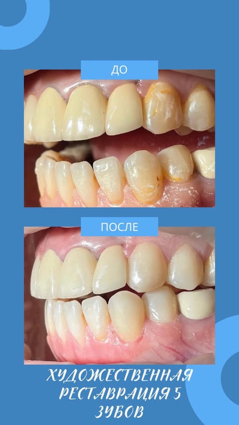 После лечения