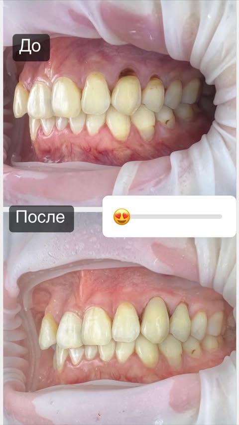 После лечения