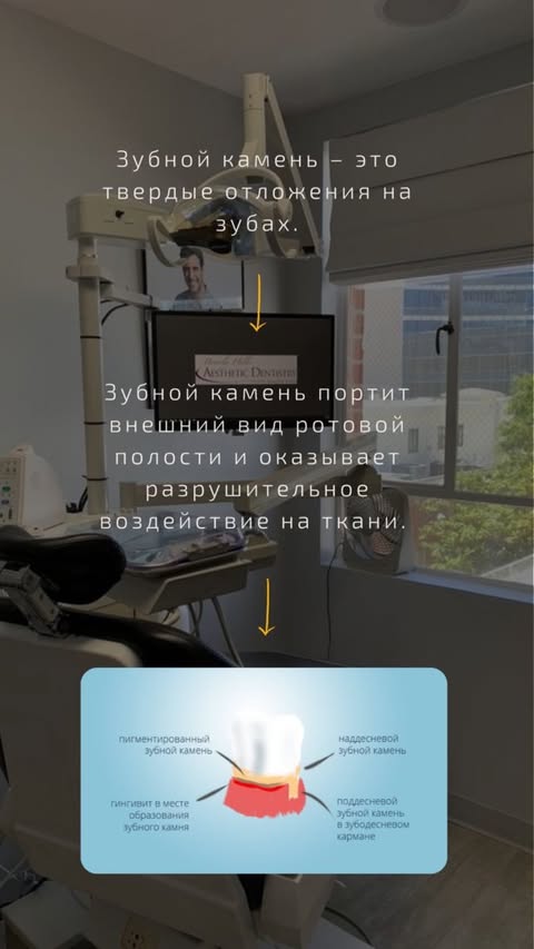 Профессиональная чистка зубов