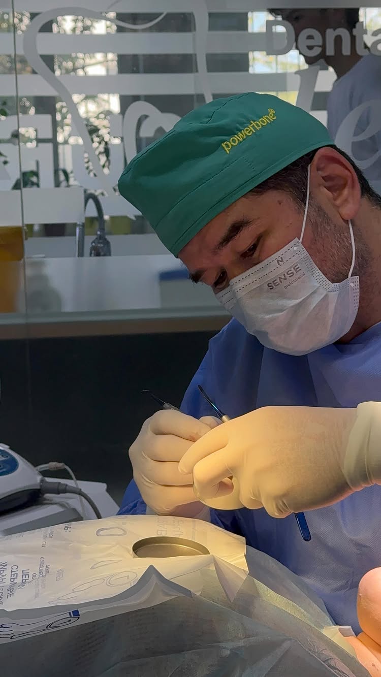 Имплантация